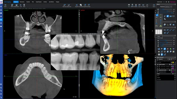Planmeca-romexis-6-2d-3d.jpg